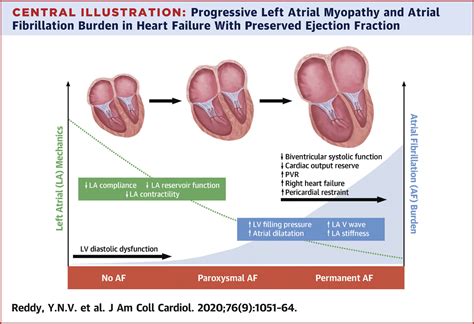 preserved left ventricular function heart failure.